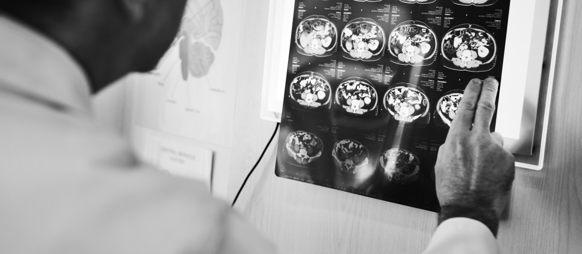 Doctor examinando una radiografía