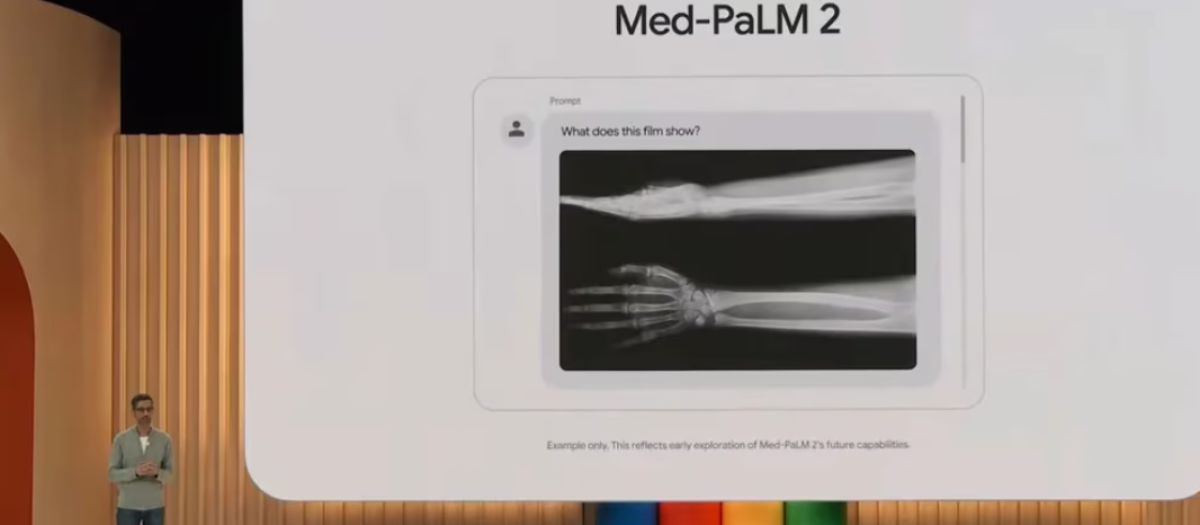 Muestra del chatbot Med-PaLM durante una presentación