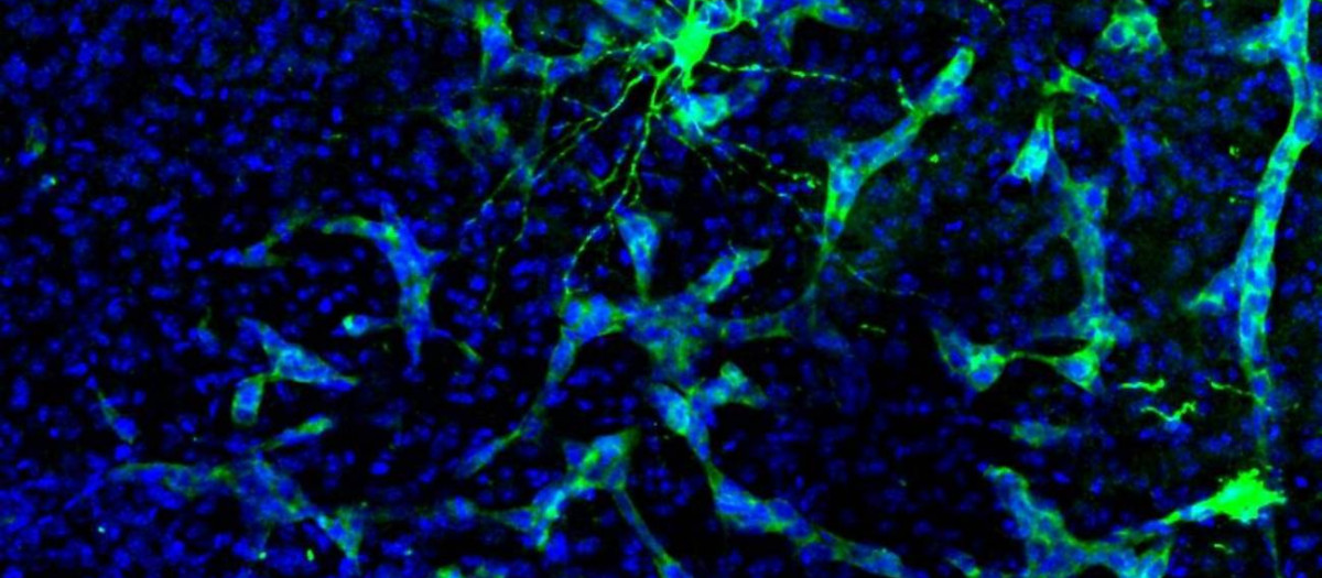 Metástasis en cerebro de ratón