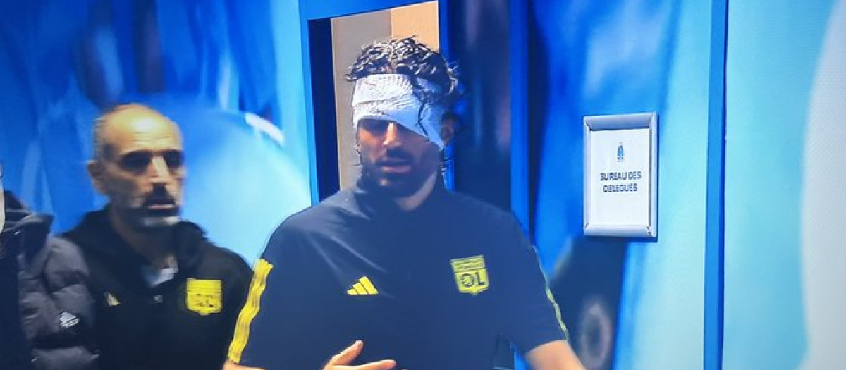 Los ultras del Olympique de Marsella han apedrado el bus del Lyon y los adoquines han alcanzado al entrenador Fabio Grosso