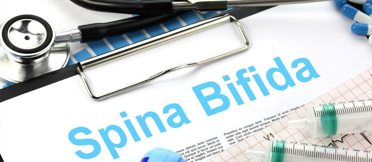 Espina Bífida