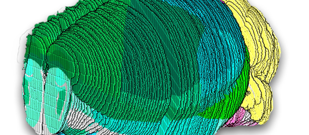 Cerebro de ratón empleado en la investigación