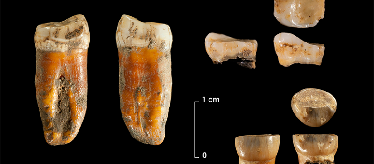 Piezas dentarias descubiertas en Axlor