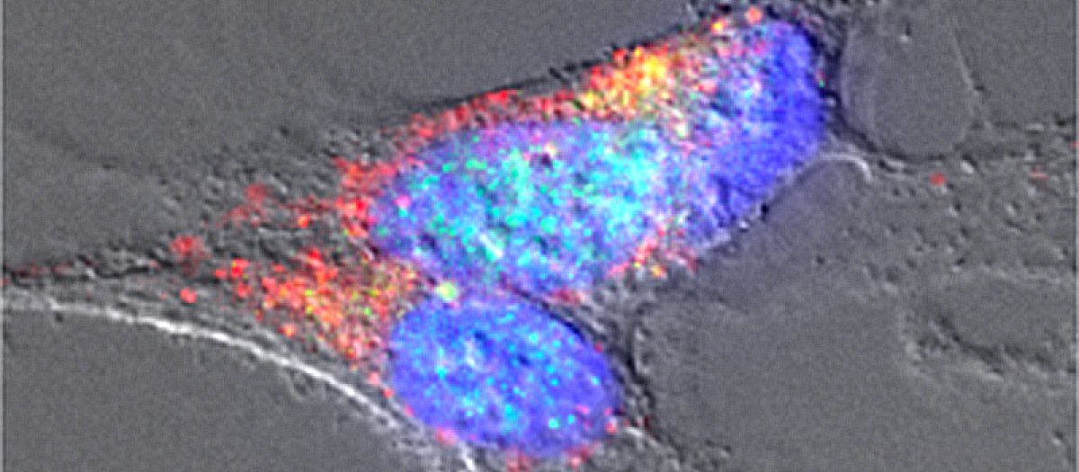 Neuronas tratadas con amiloides bacterianos
