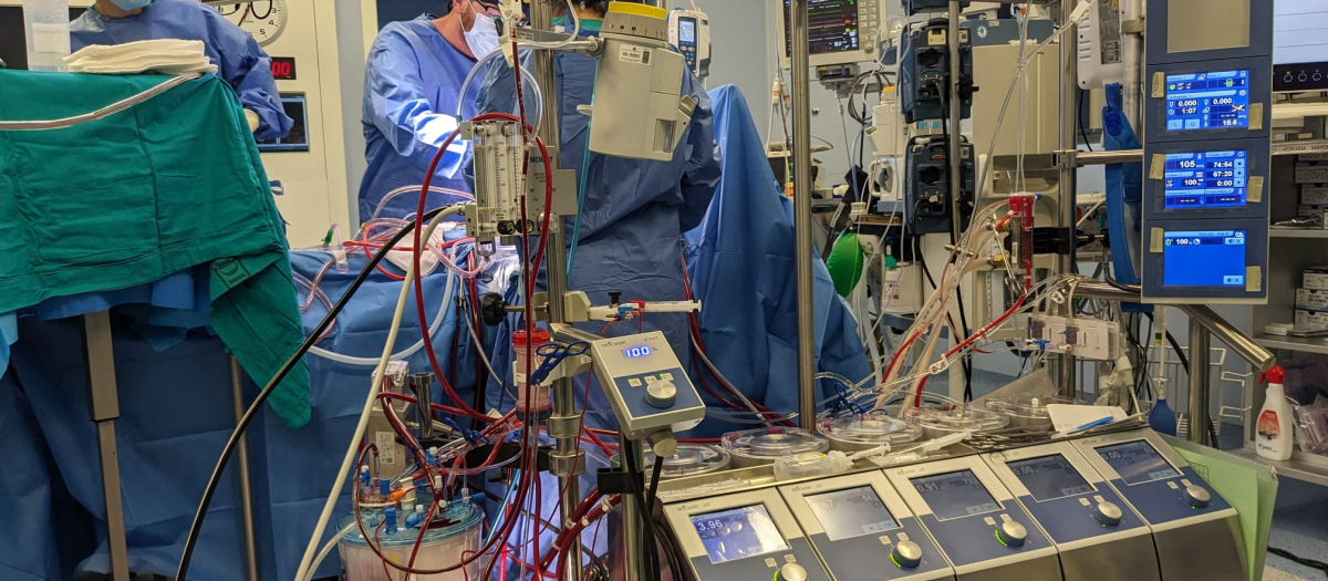 Un momento de una de las cirugías extracorpóreas realizadas recientemente en el Hospital San Juan de Dios de Córdoba (2)