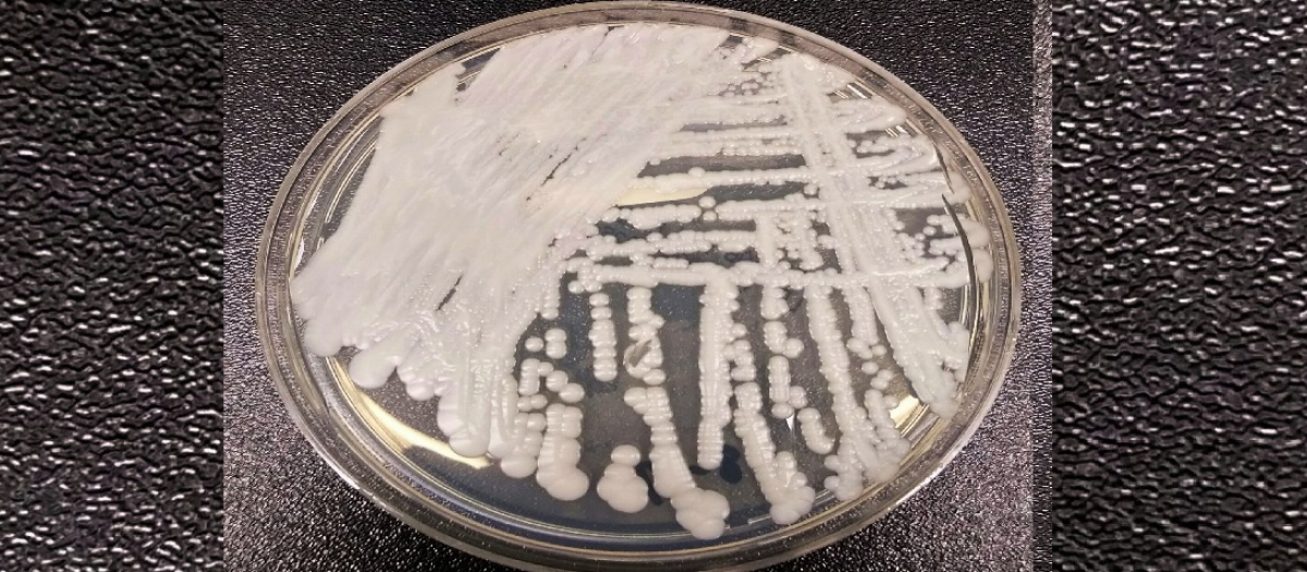 Candida auris