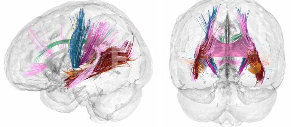 El volumen de materia gris cortical se reduce conforme avanza un embarazo