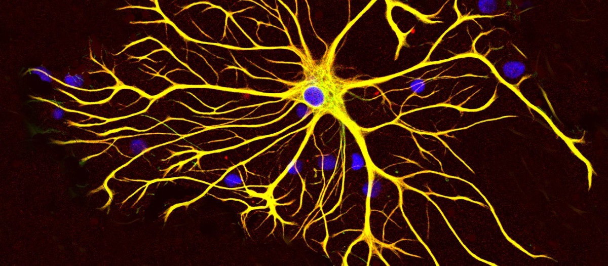 Célula astrocito de cerebro de rata teñida en cultivo