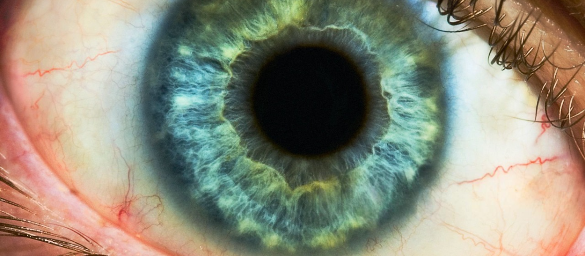 Ojo azul verdoso
