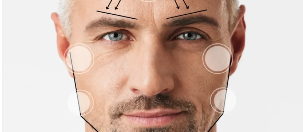 Masculinizacion facial