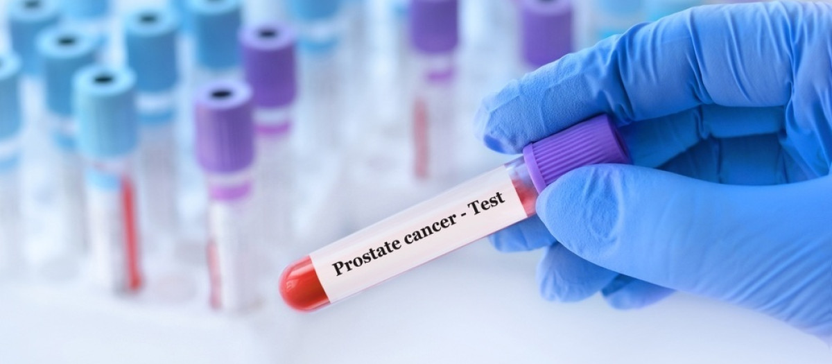 Una uróloga advierte de que el dolor óseo en hombres mayores es una "señal silenciosa" de cáncer de próstata metastásico
REMITIDA / HANDOUT por RUBER INTERNACIONAL
Fotografía remitida a medios de comunicación exclusivamente para ilustrar la noticia a la que hace referencia la imagen, y citando la procedencia de la imagen en la firma
11/6/2025
