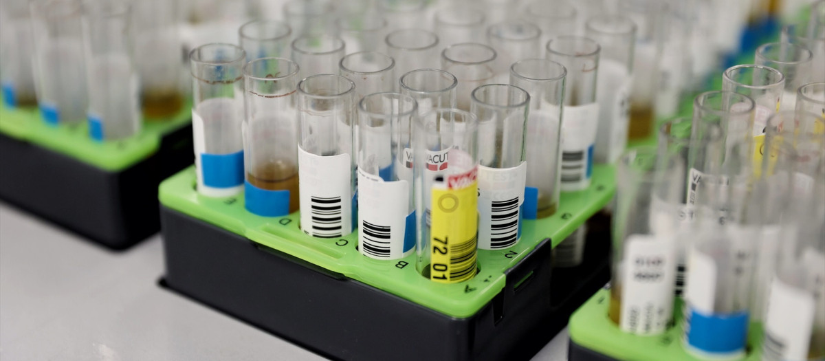 Probetas de pruebas PCR en el Laboratorio de Microbiología del Hospital público Gregorio Marañón