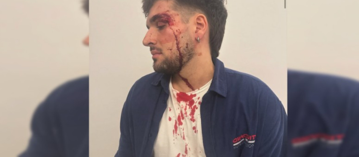 Dos personas le atacaron sin mediar parada dejándole con diversas heridas