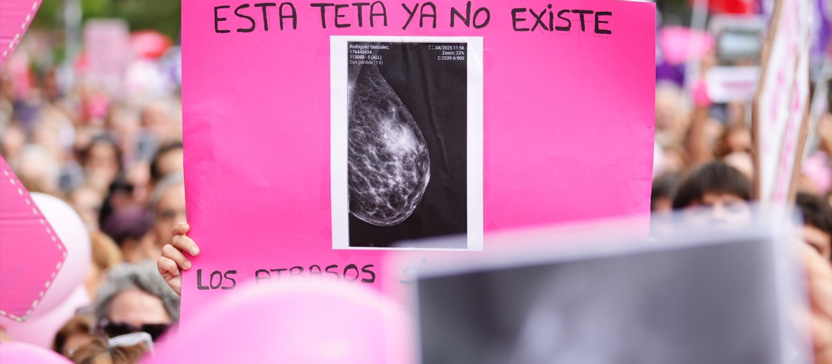 (Foto de ARCHIVO)
La ministra de Sanidad, Mónica García, ha anunciado este miércoles que las comunidades autónomas gobernadas por el PP se han comprometido a entregar los datos de los programas de cribado de cáncer de mama