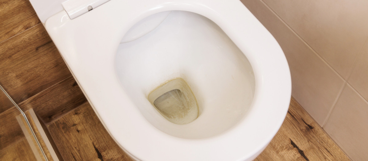 Imagen de un retrete