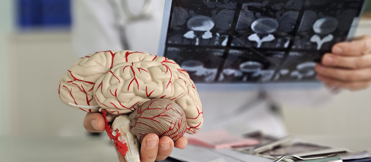 Esclerosis múltiple