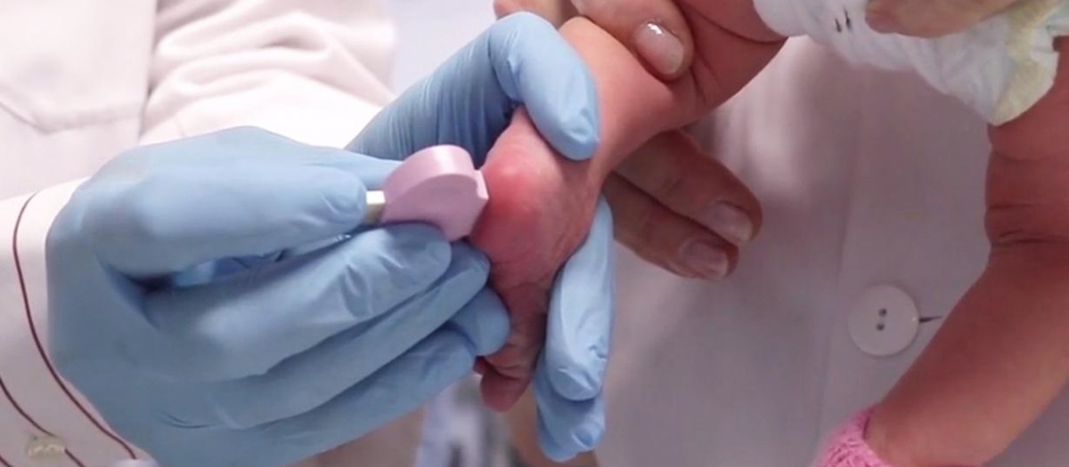 (Foto de ARCHIVO)
Prueba del talón a un bebé

REMITIDA / HANDOUT por JCCM
Fotografía remitida a medios de comunicación exclusivamente para ilustrar la noticia a la que hace referencia la imagen, y citando la procedencia de la imagen en la firma
26/11/2022