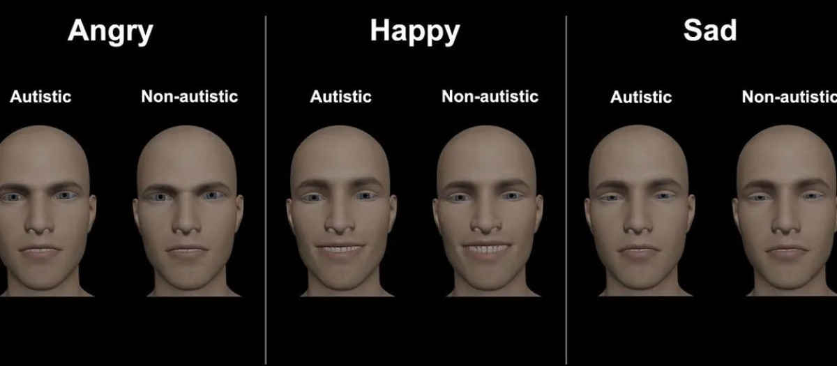El equipo encontró diferencias en las expresiones faciales de enojo, alegría y tristeza entre los grupos