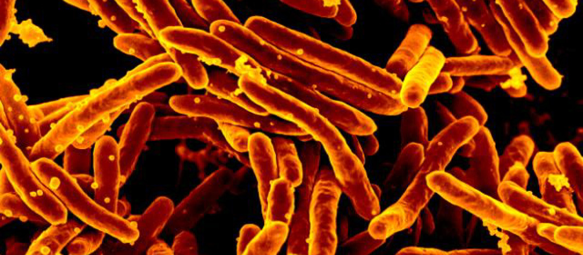 Bacteria Mycobacterium abscessus