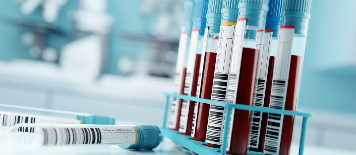 Analítica de sangre