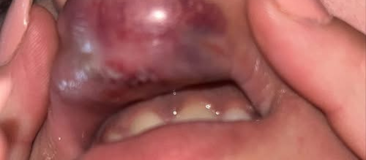 La víctima muestra la lesión sufrida en su labio