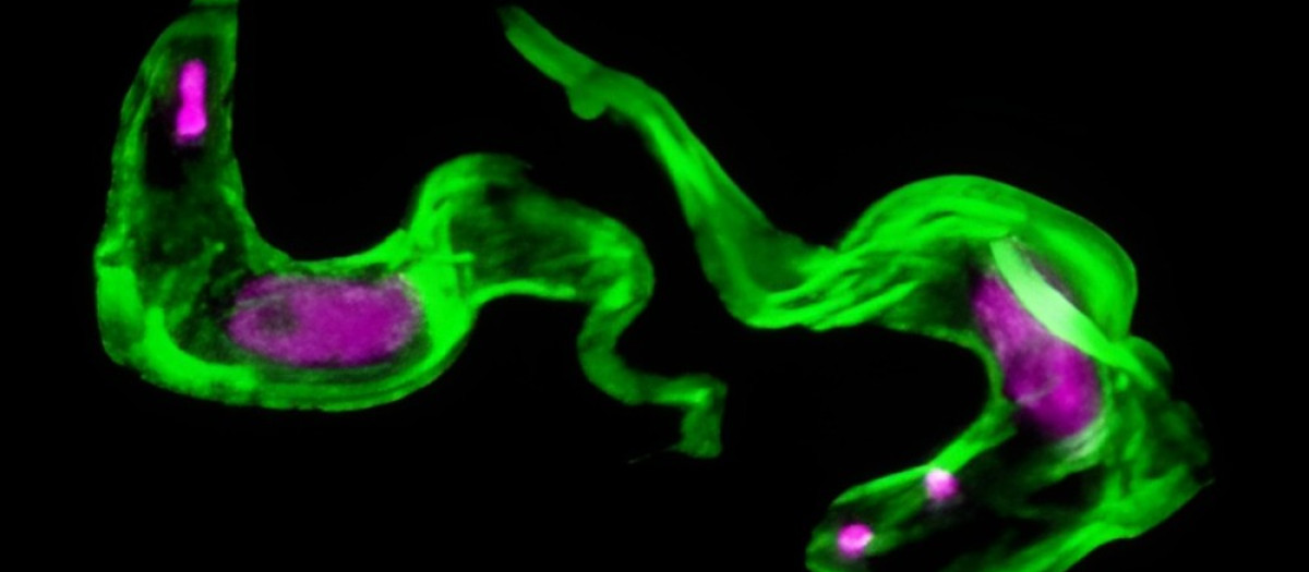 El ADN del parásito tripanosoma africano en color magenta y su capa protectora en verde