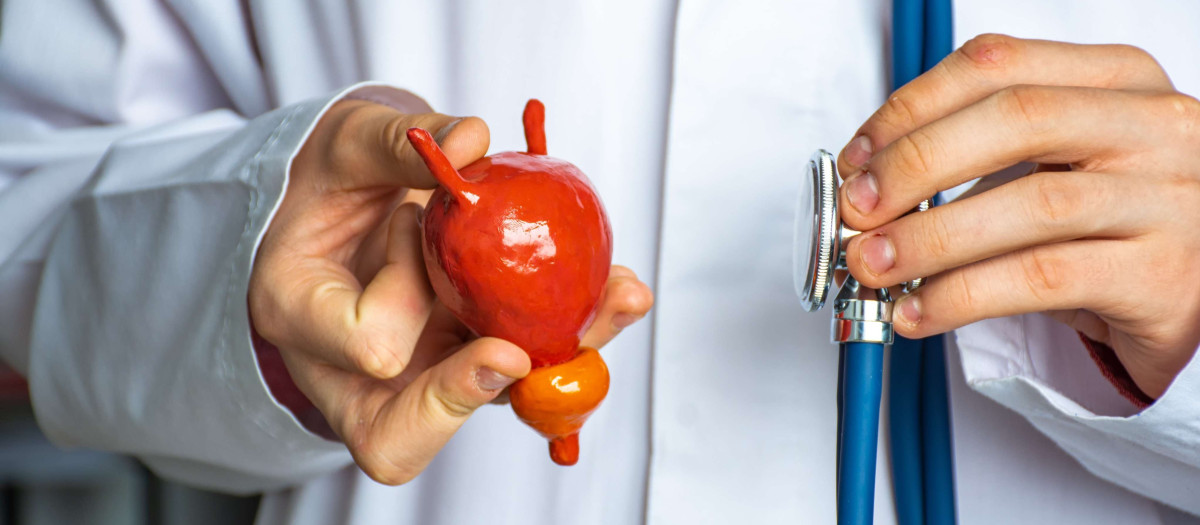 Una empresa gallega logra resultados prometedores para evitar la reaparición del cáncer de vejiga