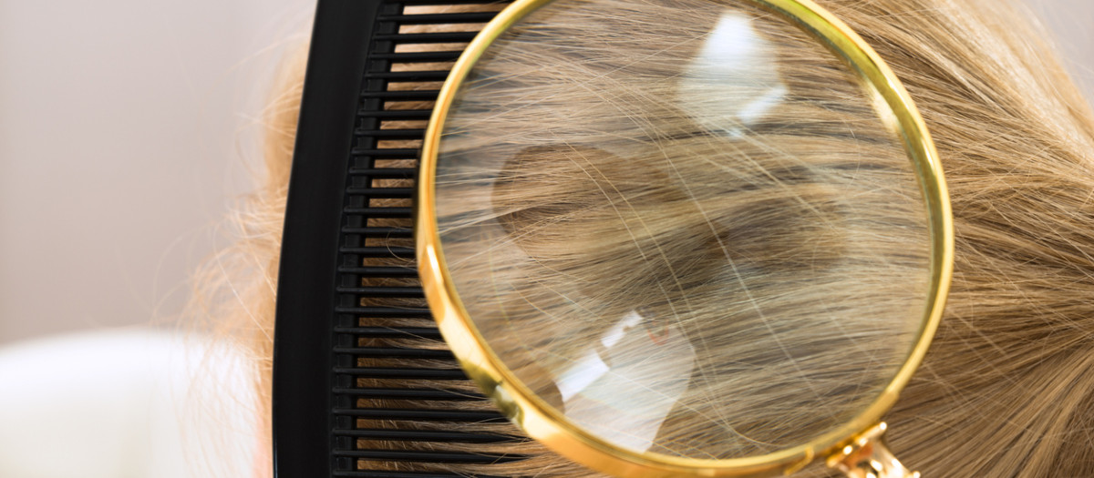 Ozempic puede estar relacionado con la caída del cabello