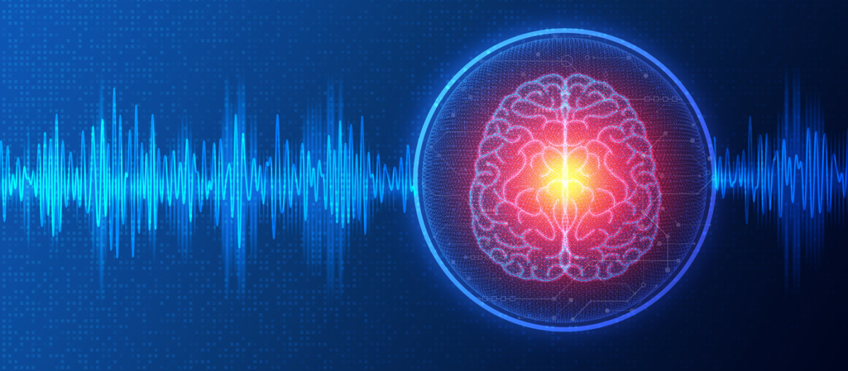 Cerebro