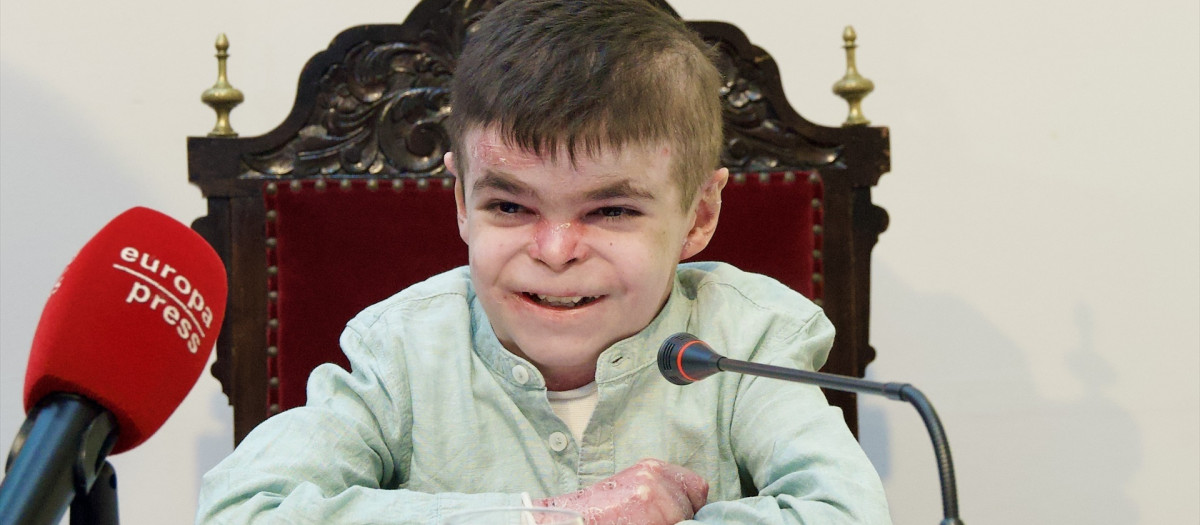 El pequeño Leo, con la enfermedad pie de mariposa