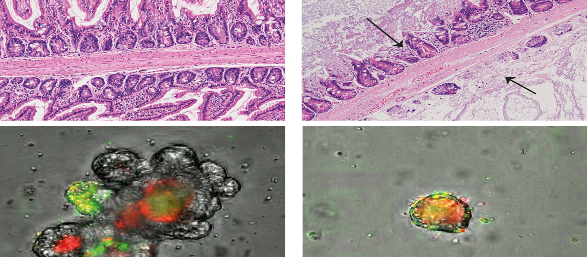 Los investigadores han concluido que el intestino es una barrera contra el paso de las bacterias a la sangre