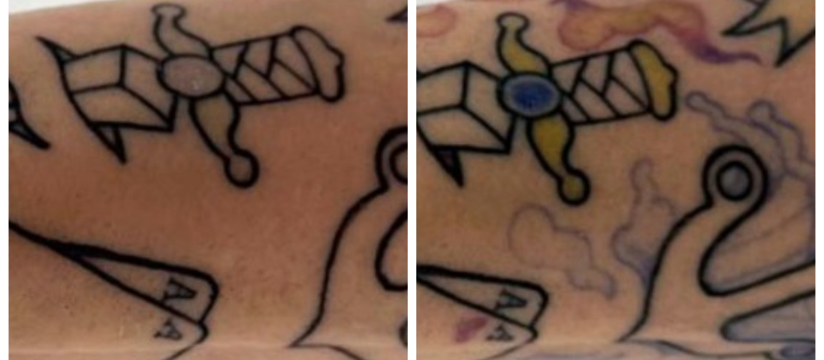 Tatuaje en el brazo antes y después de la activación de la luz.