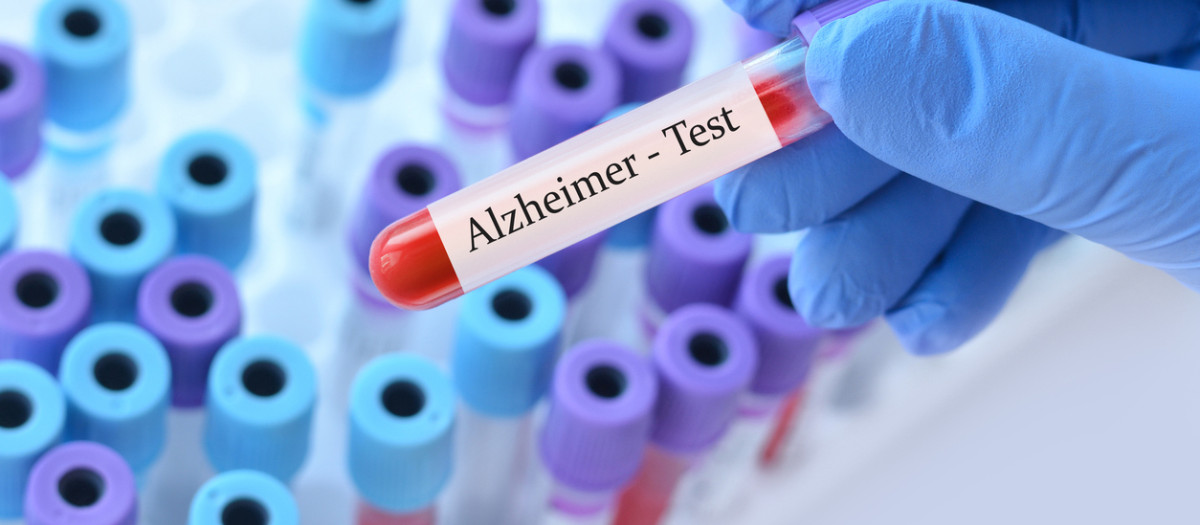 Un péptido natural podría abrir una nueva vía para diagnosticar el alzhéimer