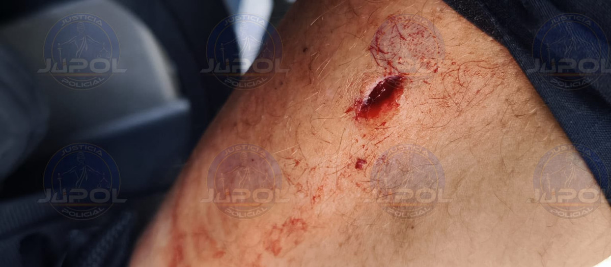 Policía herido en La Coruña