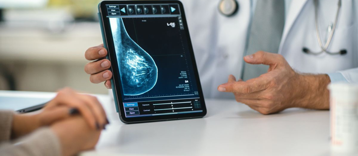Un doctor muestra una prueba diagnóstica de cáncer de mama