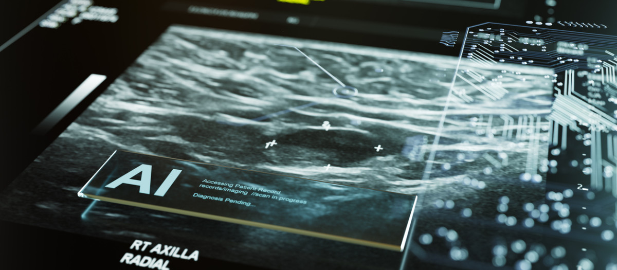 Bot médico de IA que diagnostica la mamografía de cáncer de mama