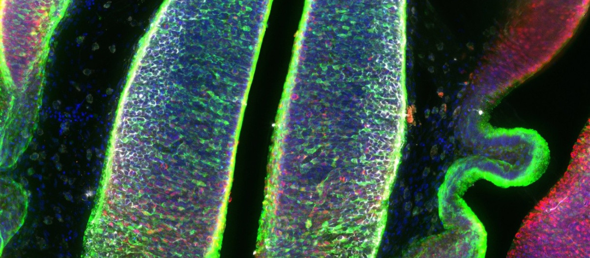 Imagen del tálamo embrionario de ratón que muestra (en verde fluorescente) las células progenitoras y su descendencia