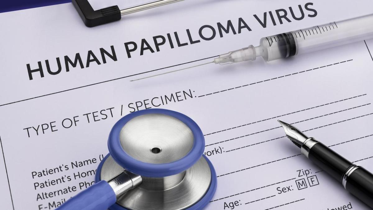 Virus del papiloma humano: ¿podremos predecir qué infecciones progresarán a cáncer?