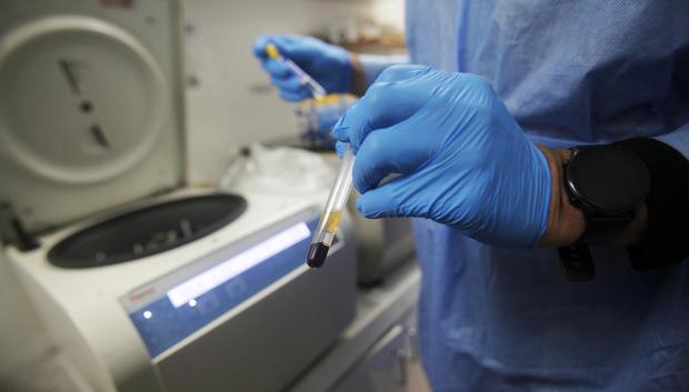 Un trabajador sanitario manipula una muestra para un examen de VIH