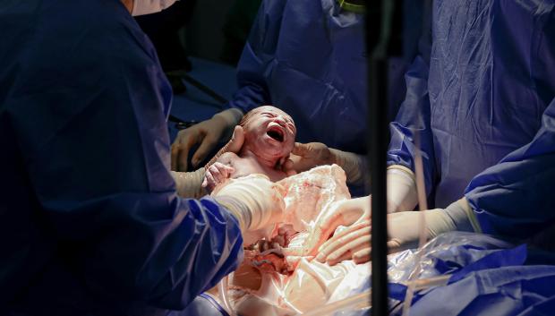 Un grupo de médicos practica una cesárea