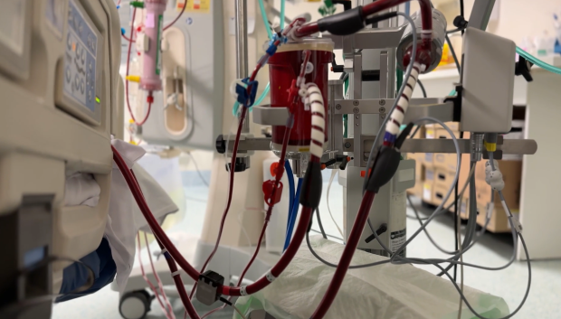 El Hospital La Paz, nuevo referente mundial gracias a una tecnología para situaciones críticas de corazón y pulmones