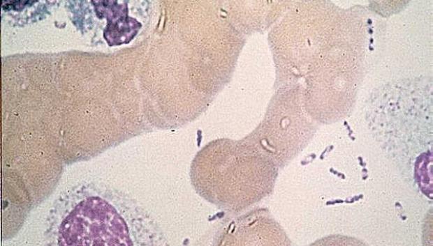 Bacteria Yersinia pestis