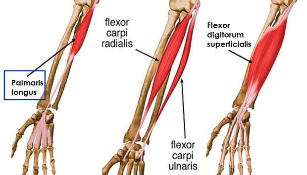 Músculo palmaris longus