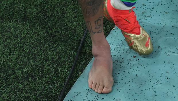 Así quedó el tobillo de Neymar que tiene en vilo a Brasil