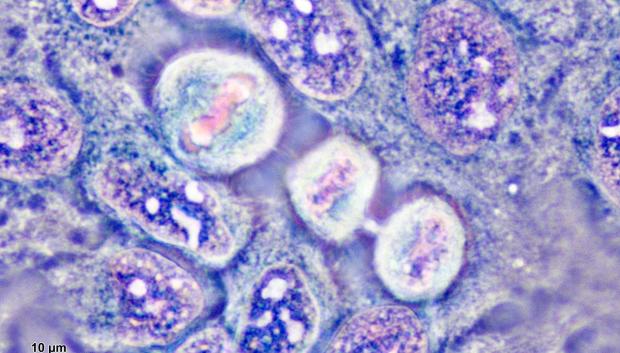 División de células HeLa en cultivo. Las células pueden verse en metafase y telofase , diferentes etapas de la división celular