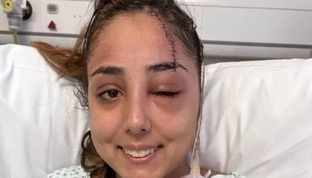 Los médicos tuvieron que dar más de 30 puntos de sutura a Jeena Panesar