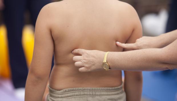 Según el estudio de la fundación Gasol, el 15 % de la población infantojuvenil en España sufre obesidad
