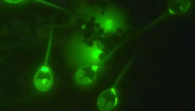 El parásito, bajo un microscopio fluorescente
