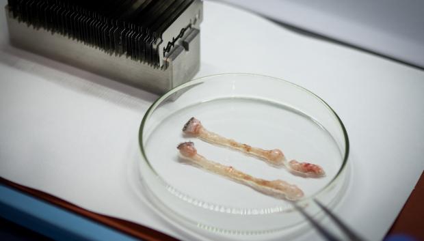 Esta imagen muestra dos biopsias de tejido adiposo extraídas de un oso polar