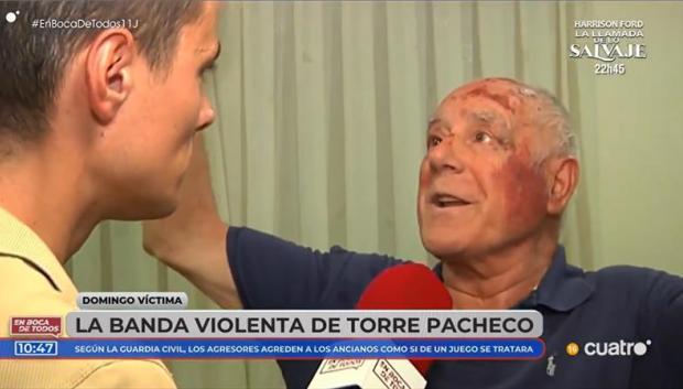 Domingo, el anciano agredido en Torre Pacheco